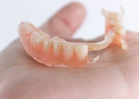 金属を使わない「入れ歯」があるのを知ってますか？