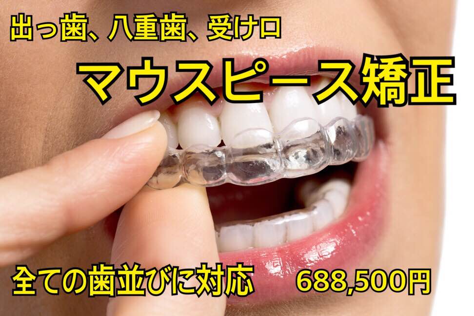 マウスピース矯正　ケンライン　出っ歯　モニター　白石文歯科医師　南青山矯正歯科クリニック　2016/9/14