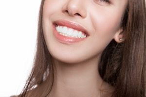 ガミースマイルが治せる人気殺到中の歯肉整形とは