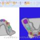 マウスピース矯正の3Dシミュレーションについて