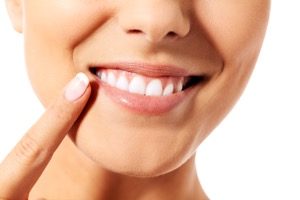 オフィスホワイトニングとセルフホワイトニングの違いについて