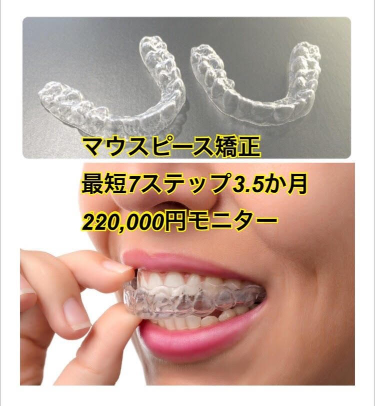 マウスピース矯正　モニター　南青山矯正歯科クリニック　2017/7/10