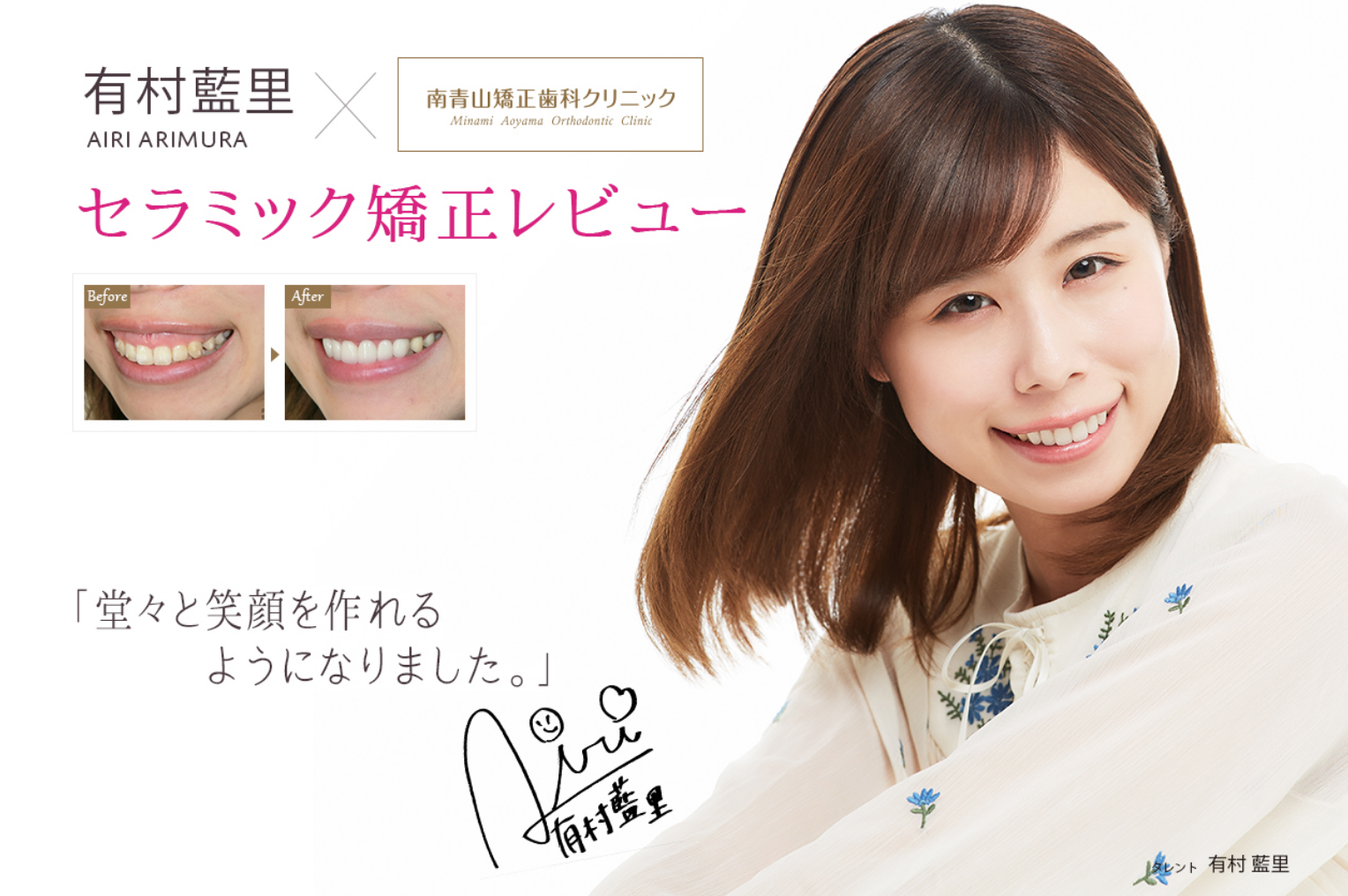 有村藍里 歯肉整形・セラミック矯正