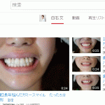 ＹＯＵＴＵＢＥ　劇的ビフォーアフター　白石文歯科医師　南青山矯正歯科クリニック　2015/7/15